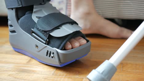 mujeres con pies rotos con una bota de plástico gris y una herida en el tobillo que protege la bota,