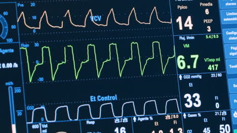monitor médico que muestra signos vitales