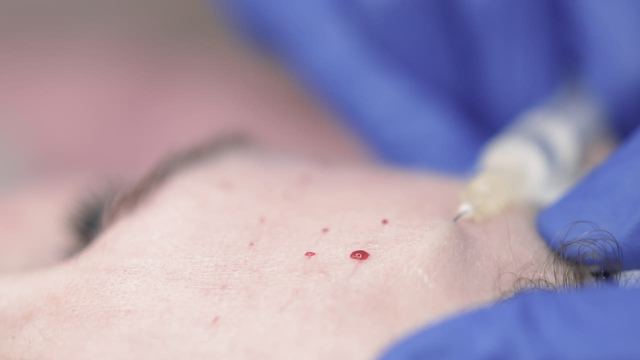 얼굴 주사 절차