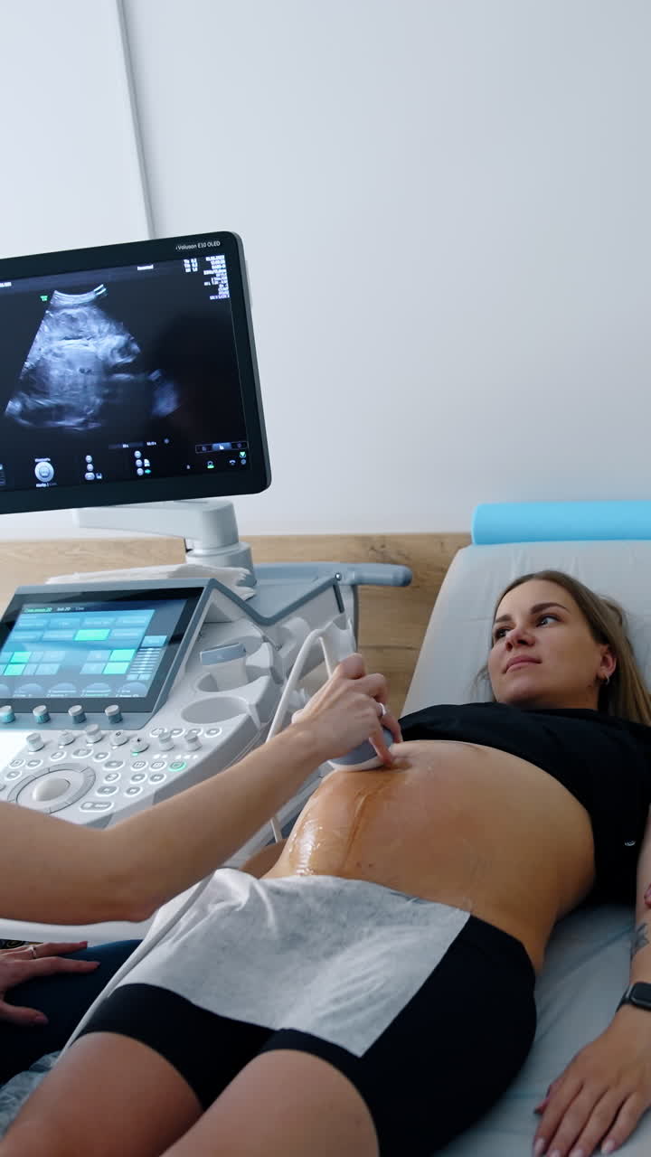 Kyiv, Ukraine, 2 May 2025: Ultrasound pregnancy diagnostic. Maternity clinic examination. Vertical video