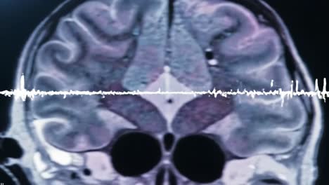 examining brain activity through mri scans and sound waves: an insightful exploration of neural patterns and their correlation with audio signals