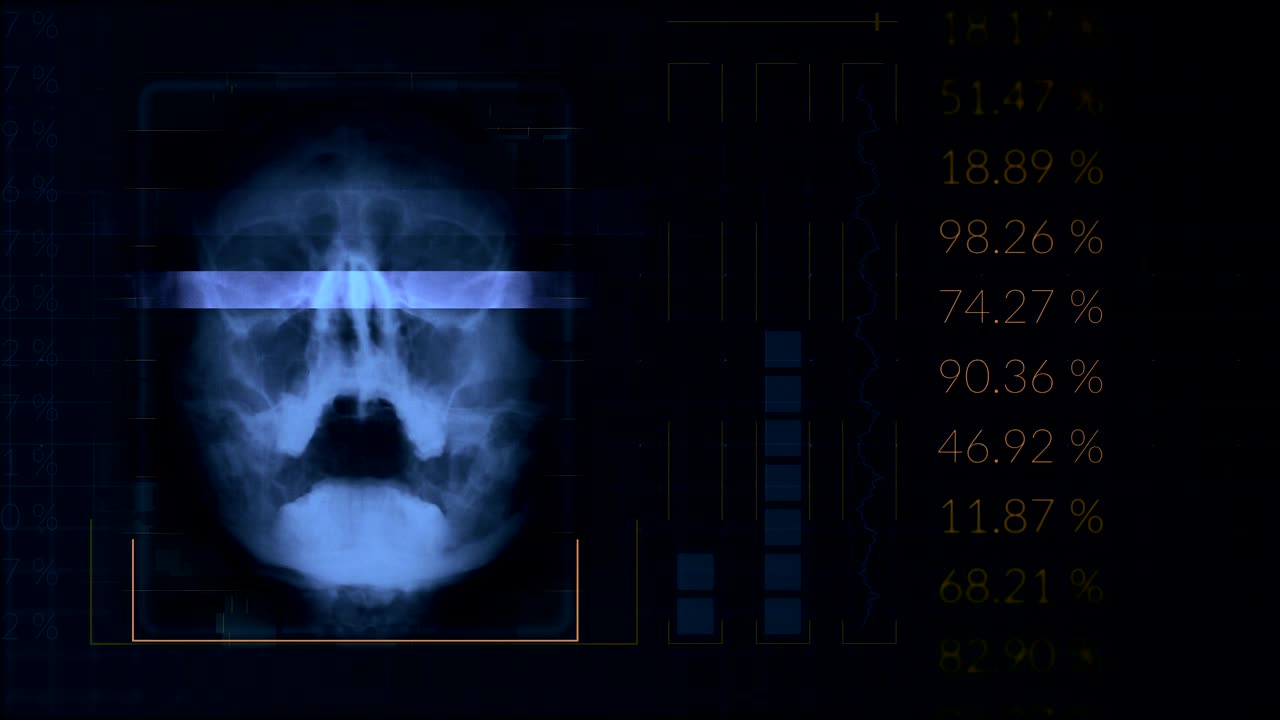 Scan of a human skull, looped Blue hud interface medical equipment