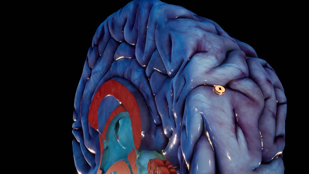 tecnología de implante de interfaz neuronal animada