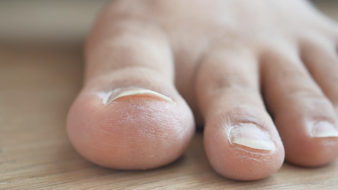 Primo piano di un piede umano e di un dito del piede