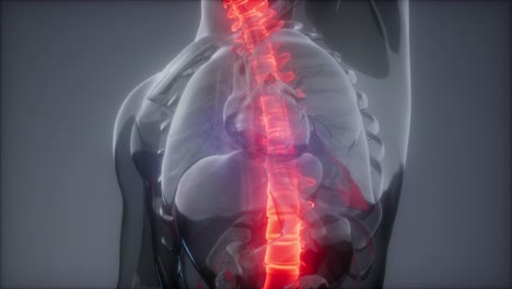 backache in back bones