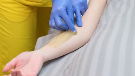 waxing a patient's arm
