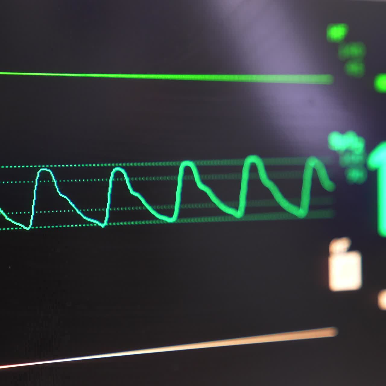 Monitor of lung ventilation equipment with life parameters of patient under surgery. Close up