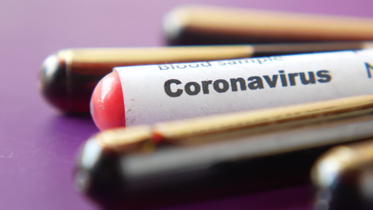 Koronavirüs Kan Örneği Test Tüpü