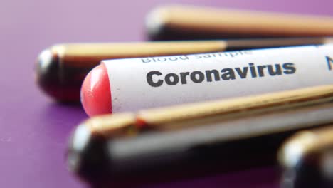 tubo de ensayo de muestra de sangre de coronavirus