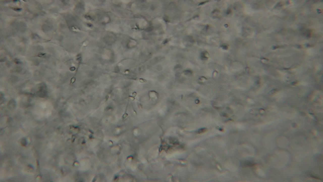 Microscopic view of moving human sperm cells with visible heads and flagella against a light background, commonly used in fertility and reproductive studies