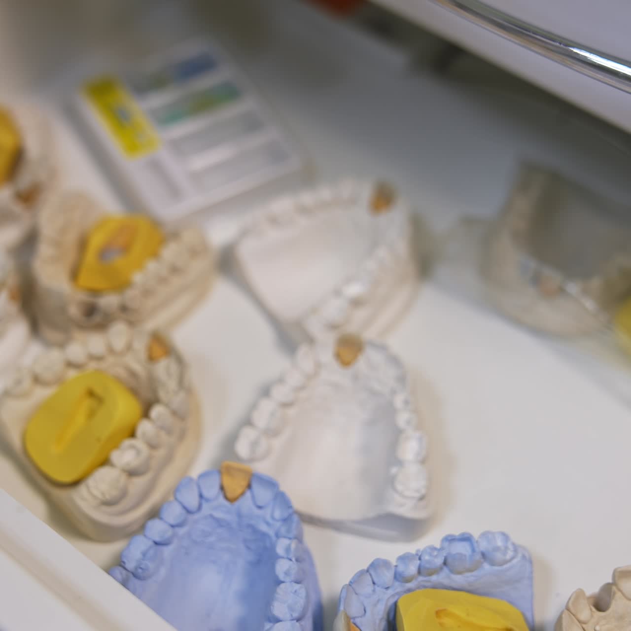 Gloved hand with wrist watch opens a drawer with plaster models of teeth. Person picks one model, puts it back and takes another one, then closes the drawer. Close up