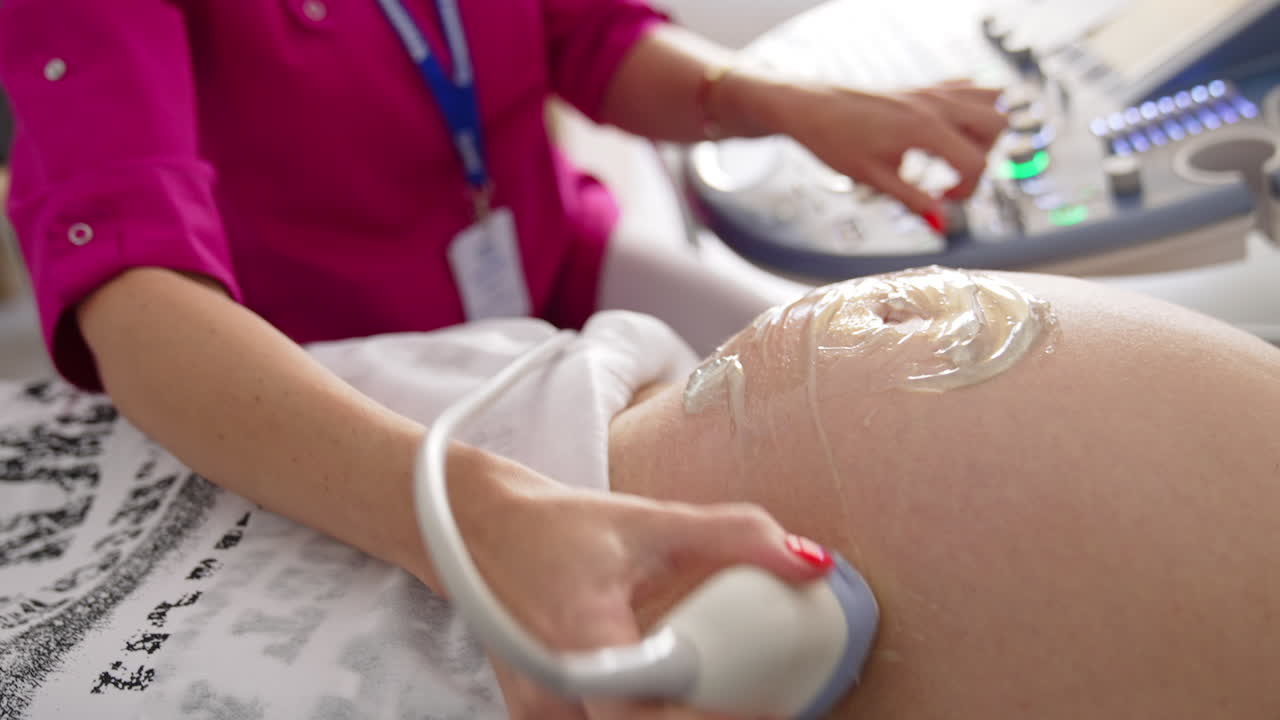Sonogram procedure to a pregnant woman. Doctor doing ultrasound in the hospital. Pregnancy and healthcare concept. Close-up.