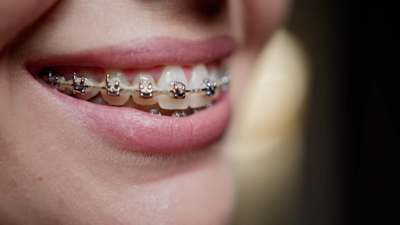 Woman with braces