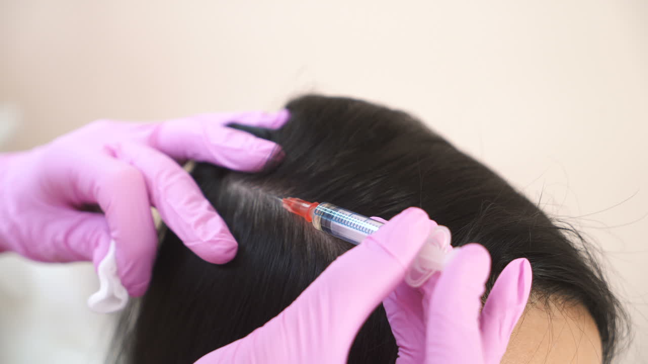 Beautiful young woman receives an injection in the head in the center of aesthetic medicine. Prevention and treatment of hair growth