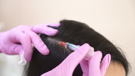 beautiful young woman receives an injection in the head in the center of aesthetic medicine. prevention and treatment of hair growth