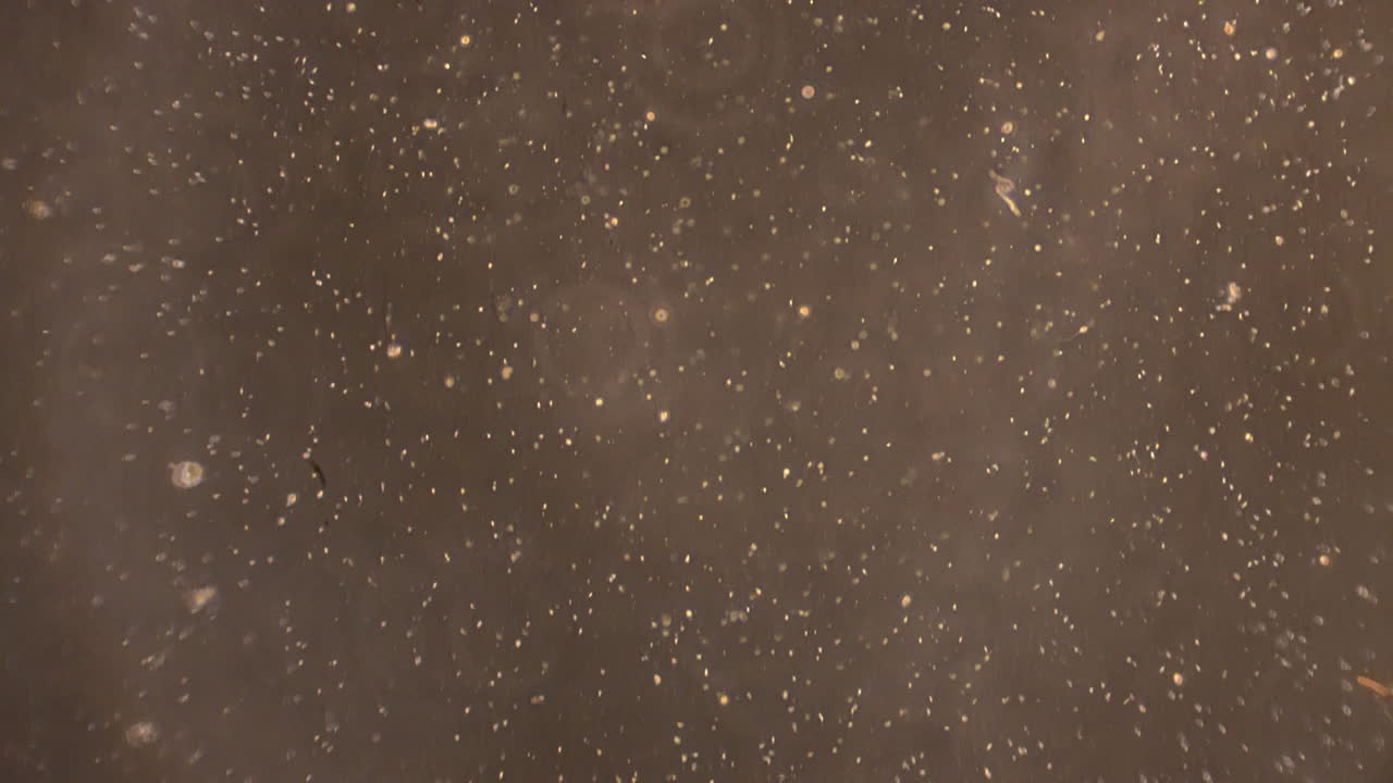 미세한 정자 세포를 가로지르는 카메라 트랙