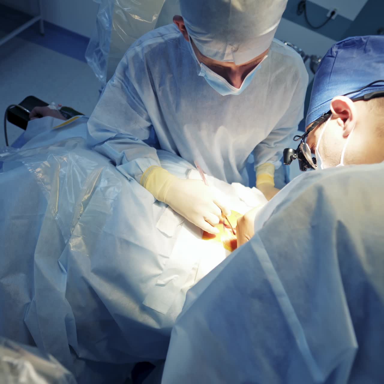 Advanced surgical room. Professional surgeons in medical uniform perform an operation in the hospital. Modern medical equipment in the operating room. Panoramic view.