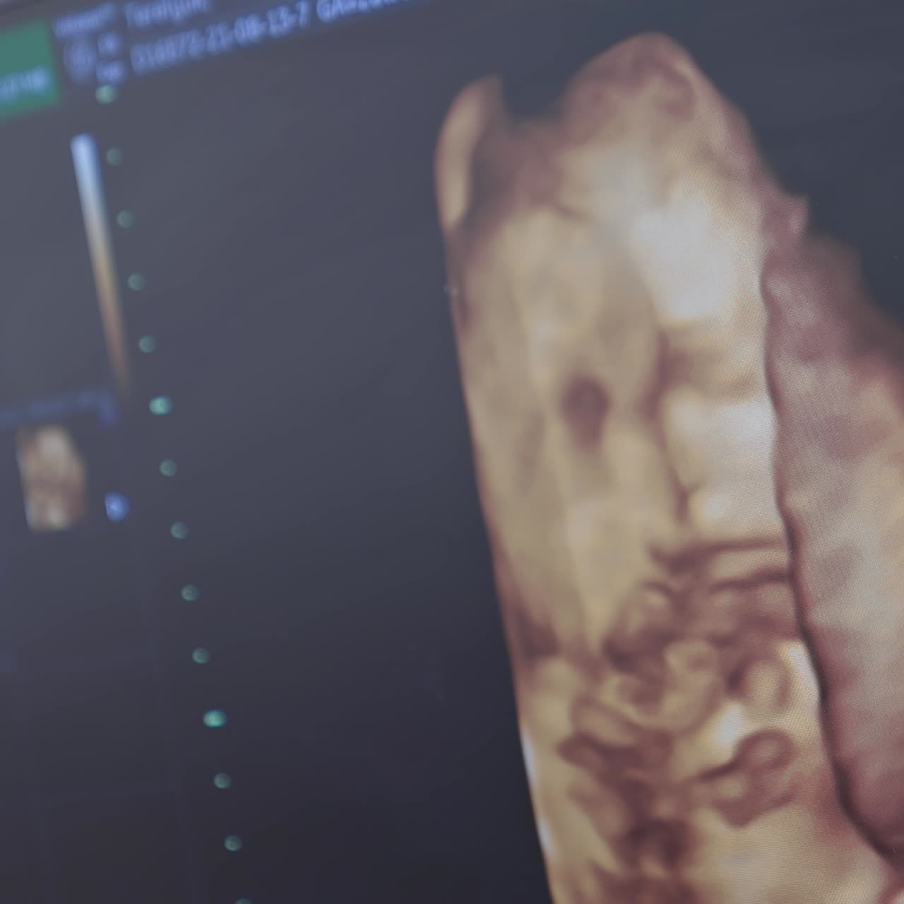 Ecografia del feto nel grembo materno. Concetto di gravidanza e salute. Screening prenatale.