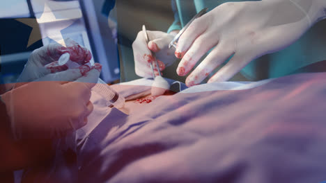 animation of flag of chile over surgeons in operating theatre