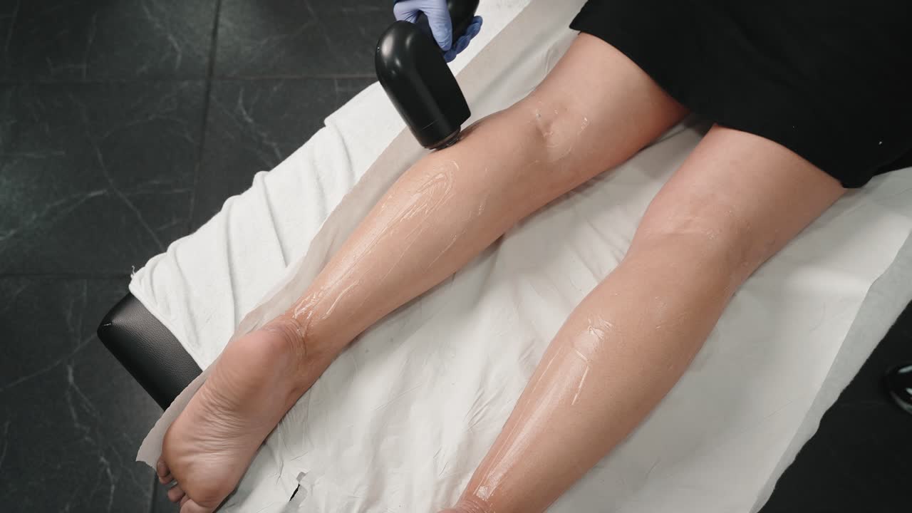 Epilazione laser sulle gambe di una donna, con un tecnico guantato che applica il trattamento