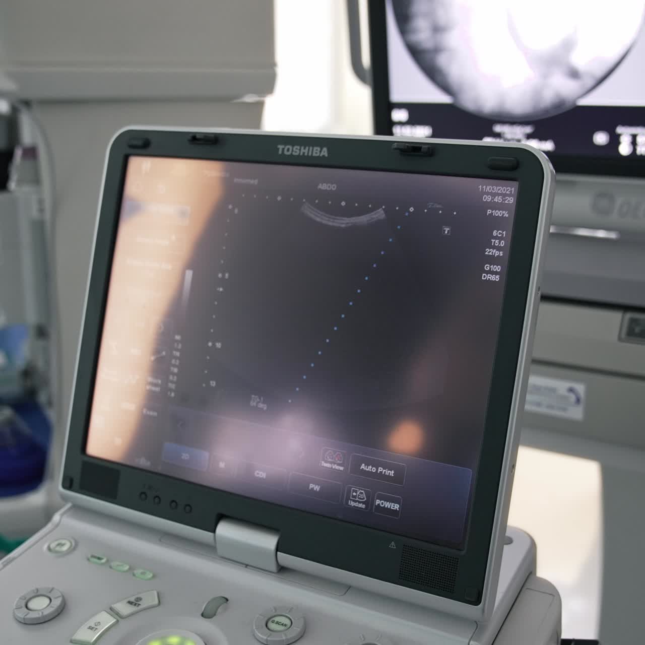 Surgery modern equipment in hospital. Medical operating devices