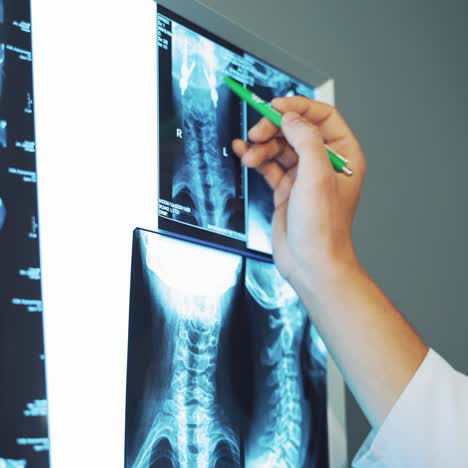 surgeon looking at patient x ray