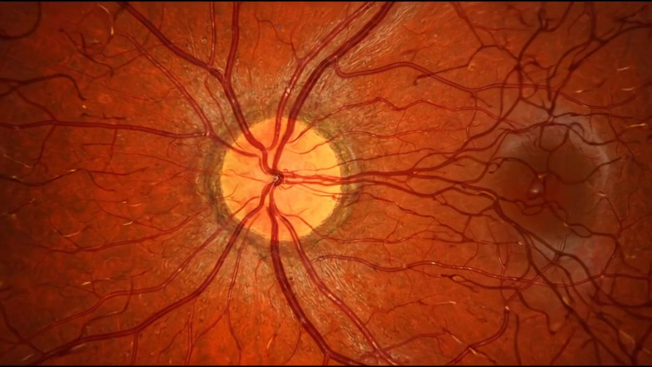 Medical Animation of Human Retina and Optic Nerve