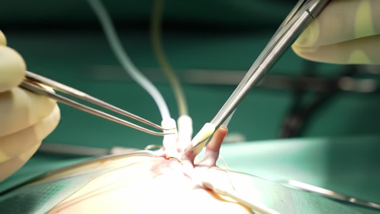 Surgeons perform a delicate operation, showcasing intricate techniques and teamwork in a clean healthcare setting. The careful handling of instruments ensures patient safety and success.