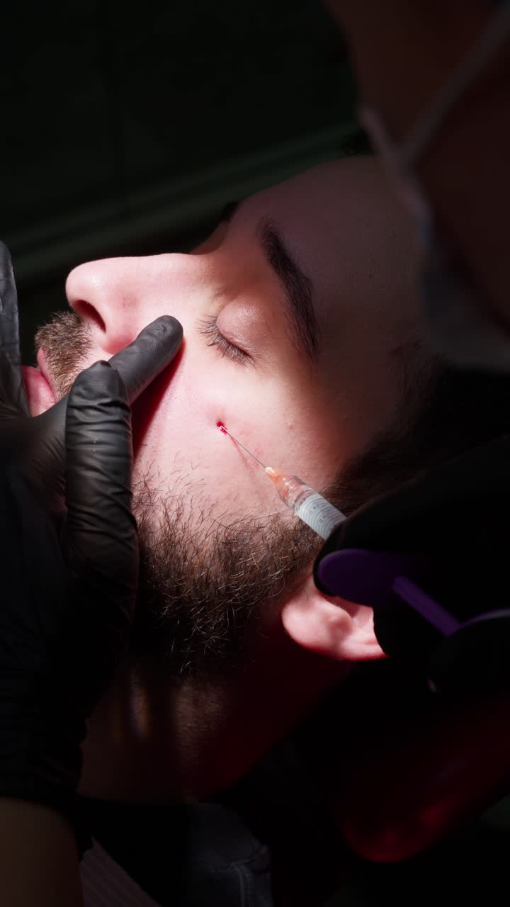 Uomo che riceve un'iniezione facciale durante una procedura estetica.