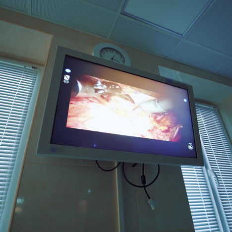 future of medicine. da vinci surgery. medical operation involving robot.