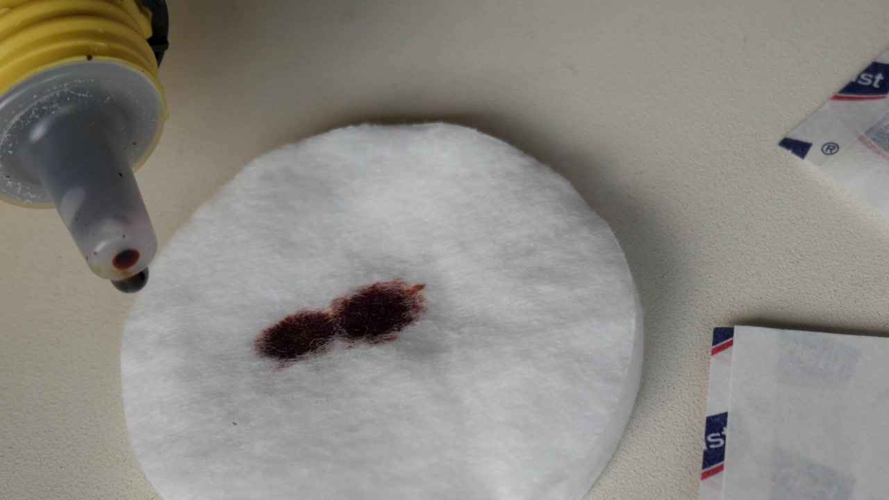 Goccia di disinfettante rosso scuro sull'ugello di una bottiglia gialla accanto a strisce