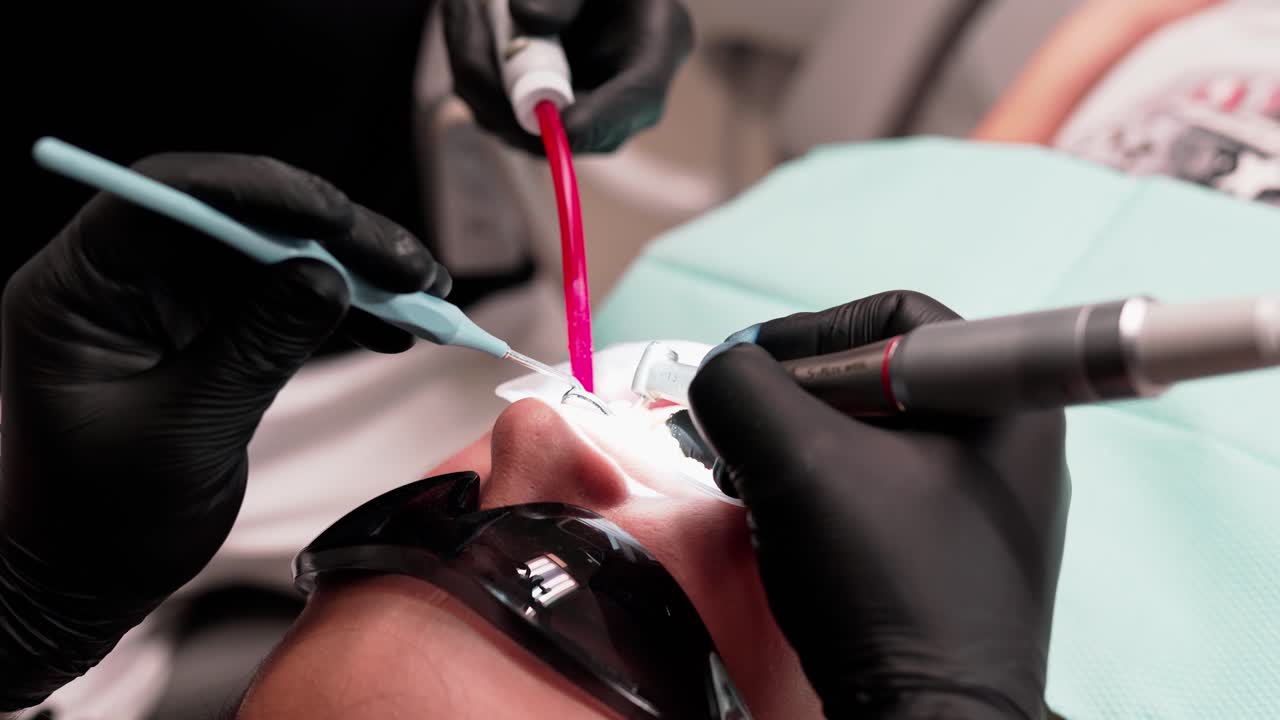 Dentist operation of female teeth. Dentist surgeon performing operation of woman patient in clinic