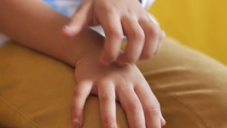 niña que sufre de picazón en la piel de la mano,