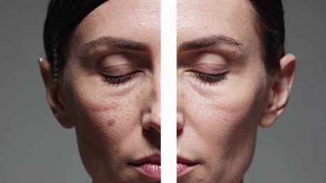 anti-aging treatment before and after