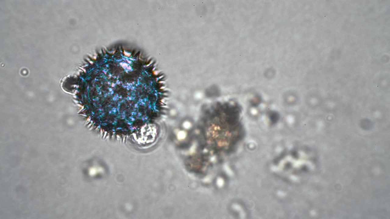 célula azul redonda similar a un coronavirus ampliación del virus covid-19 en un microscopio