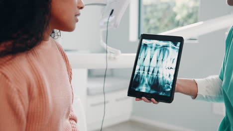 dentist showing patient their dental x-ray on a tablet