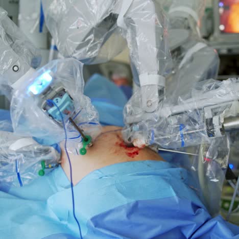 surgical process with robotic device. futuristic machine perform the complicated surgery. minimally invasive surgical innovation. modern technologies in the hospital.