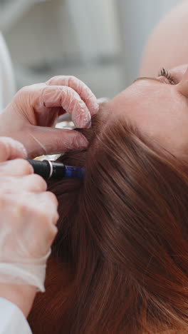 trichologist doing woman improve hair growth procedure dermapen microneedling vitamin injections