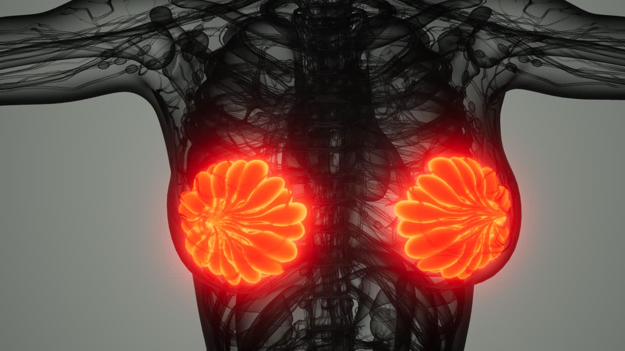 여성 유방암 의 의학적 검사