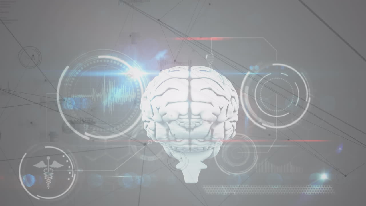 Animation of network of connections with human brain and medical data processing