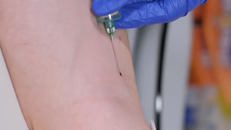 close up of doctor or nurse taking a blood sample from arm vein with a vacutainer. syringe to venipuncture the patient