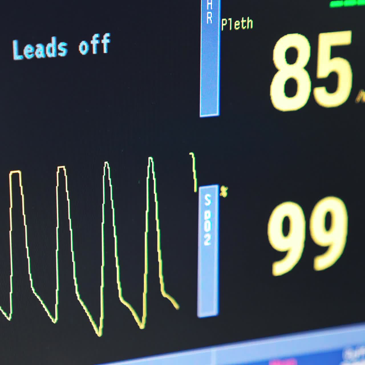 Black screen of a monitor with curve line of patient's pulse. Equipment necessary during operation close up
