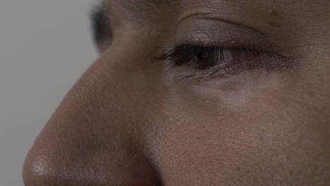 Vitiligo-Unter-Dem-Linken-Auge-Eines-Erwachsenen-Britischen-Asiatischen-Mannes