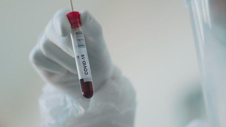 COVID-19 Blood Sample Analysis