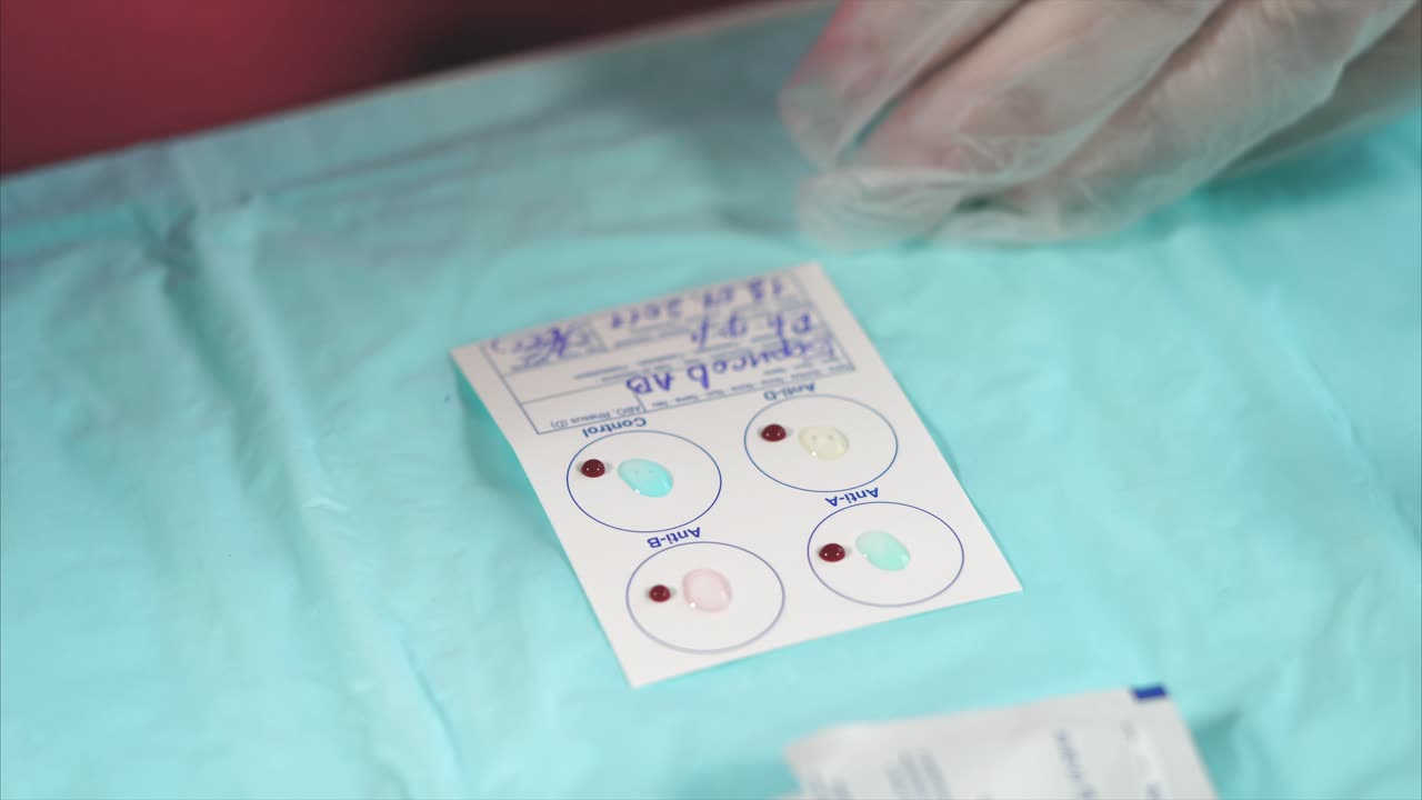 Blood Test Procedure