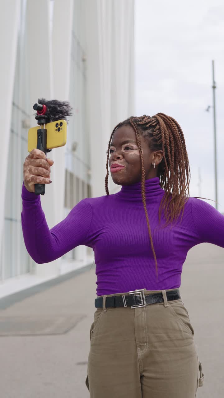 Donna con vitiligine che realizza un vlog con il suo telefono