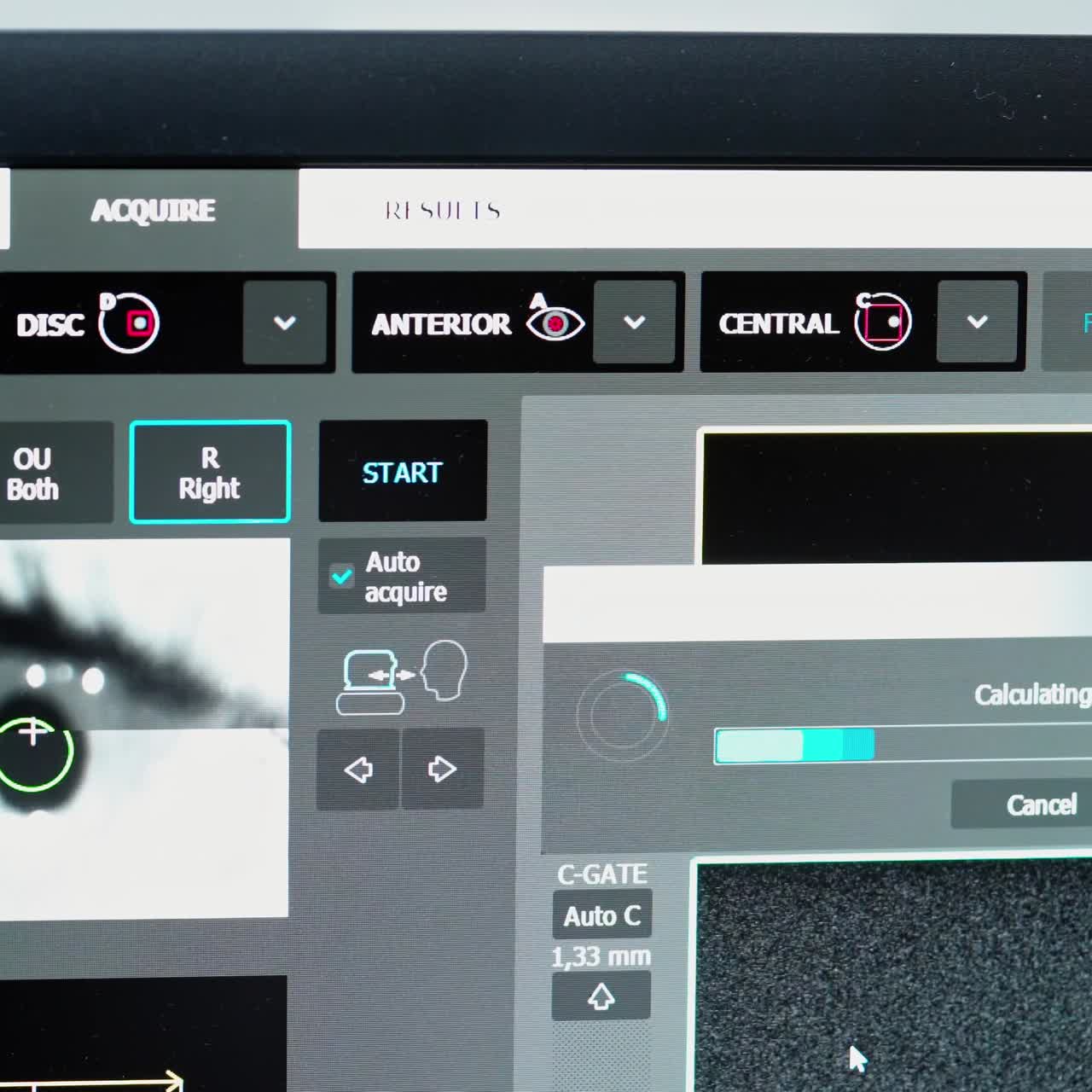 Digital microscope during medical examination