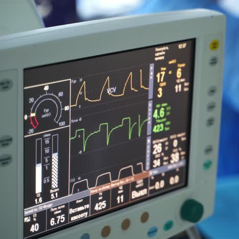 motion of lines on a medical monitor. graphs showing heart beat of a patient in surgical room. medical equipment. close-up