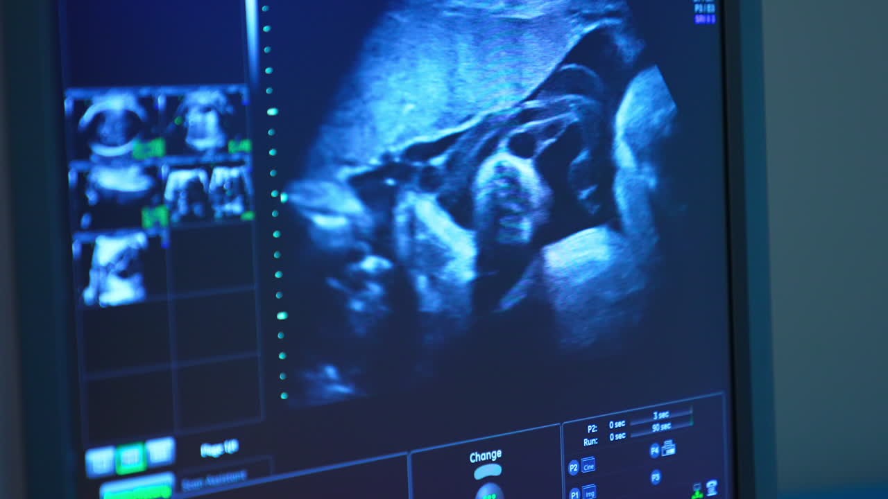 Blue monitor showing the baby movement in mother's belly. Close up. Ultrasound examination of a pregnancy.