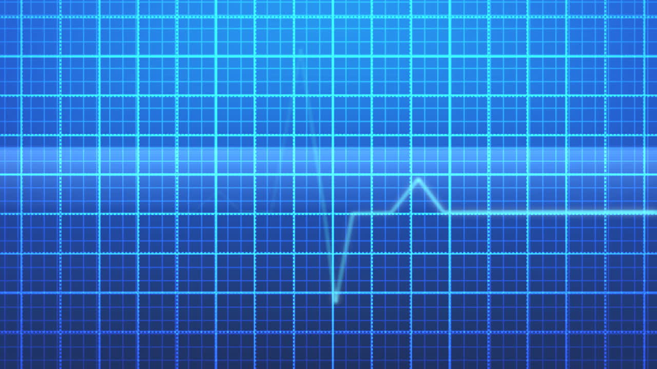 Monitor digital de frecuencia cardíaca de electrocardiograma sobre cuadrícula azul